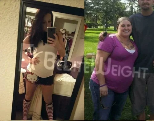 Teri B - 2 Year Update *